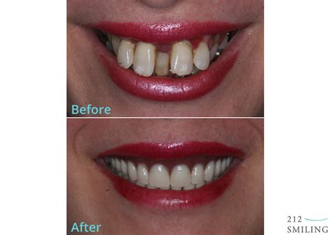 same day teeth in ashford|Same day teeth in ashford .